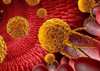 「第1相試験：セリンおよびグリシン不使用の食事が大腸癌における免疫応答を向上させる」