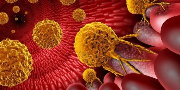 「第1相試験：セリンおよびグリシン不使用の食事が大腸癌における免疫応答を向上させる」